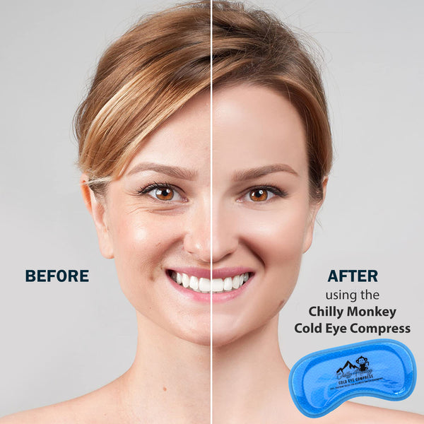 Unveiling the Refreshing Perks of Cooling Eye Masks for Soothing Eyes and Headaches